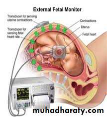 Ultrasound