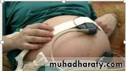 Ultrasound