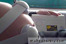 Ultrasound