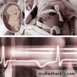 Ultrasound