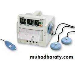 Ultrasound