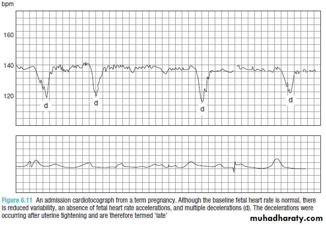 Ultrasound