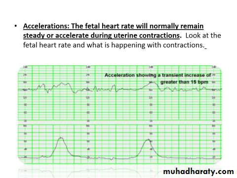 Ultrasound