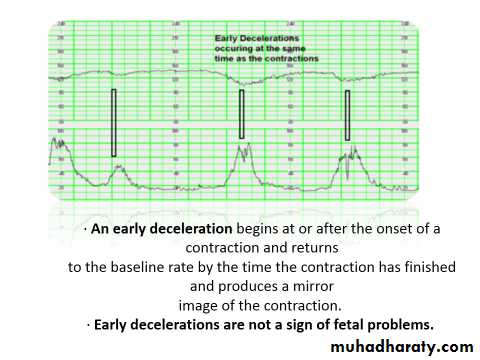 Ultrasound