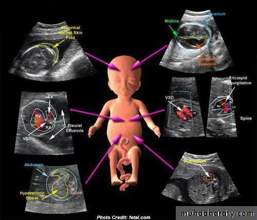 Ultrasound