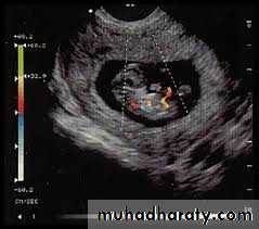 Ultrasound