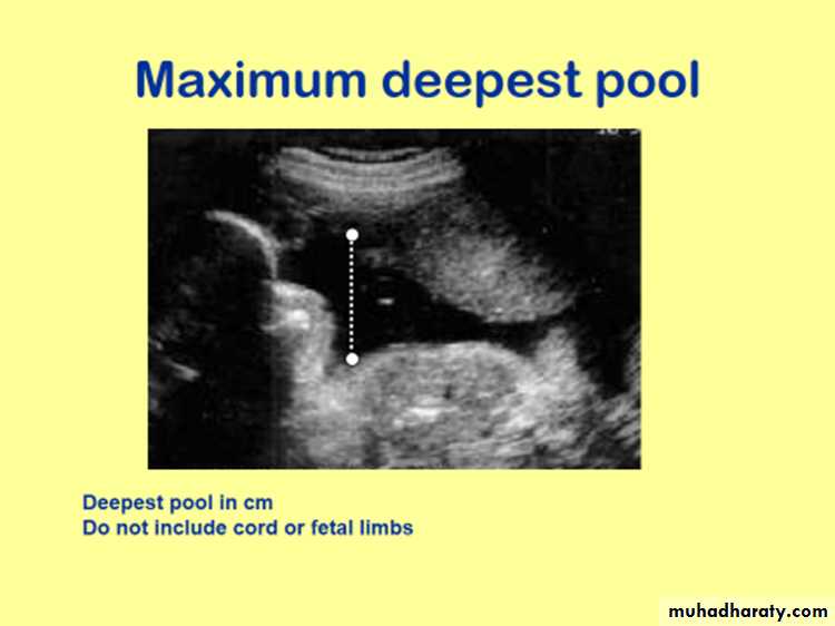 Ultrasound