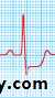 STEMI
