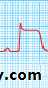 STEMI