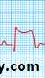 STEMI