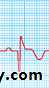 STEMI