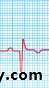 STEMI