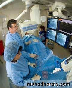 STEMI
