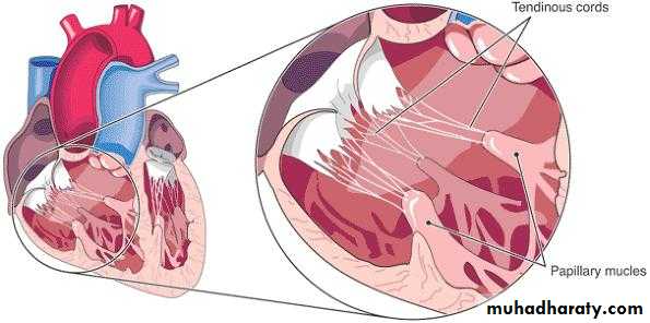 STEMI