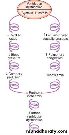 STEMI
