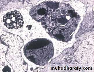 Principles of Oncology