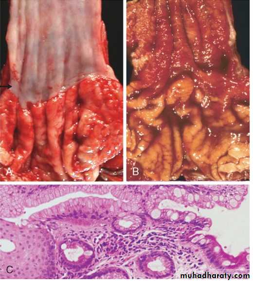 Esophagus