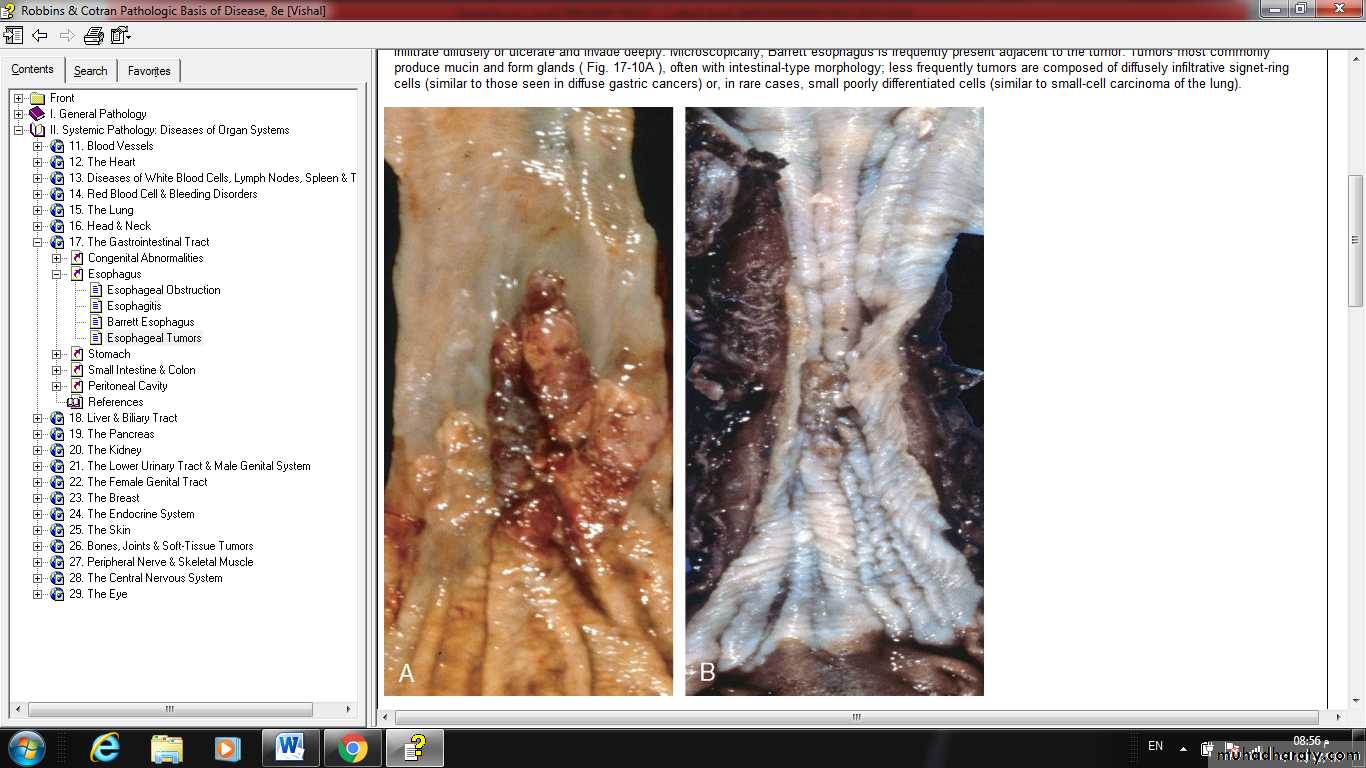 Esophagus