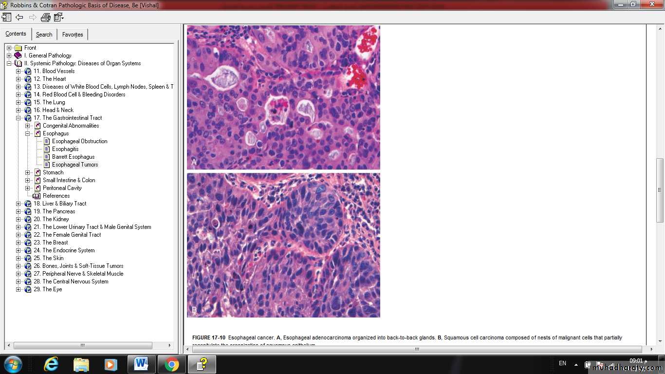Esophagus