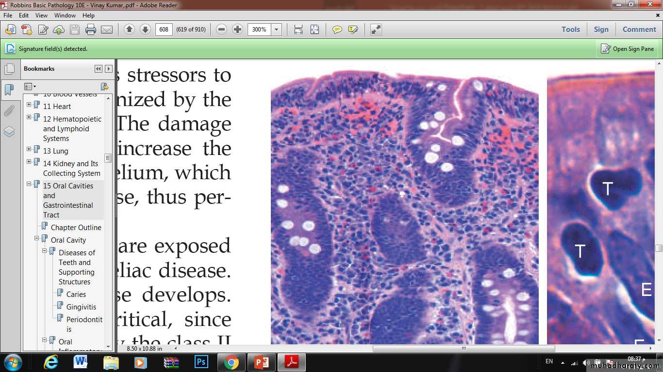 Small and Large Intestines