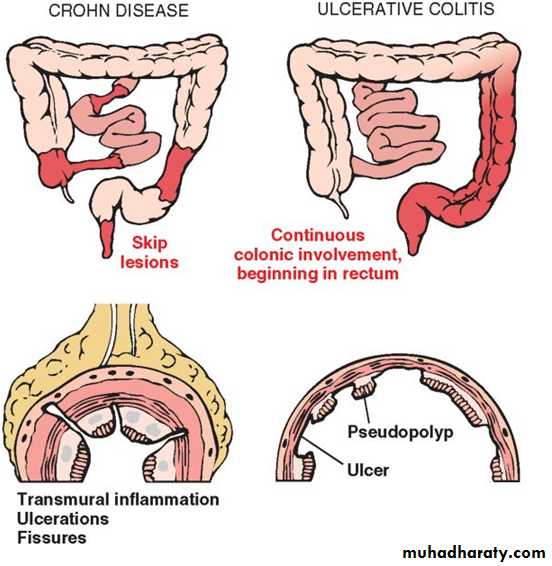 Small and Large Intestines