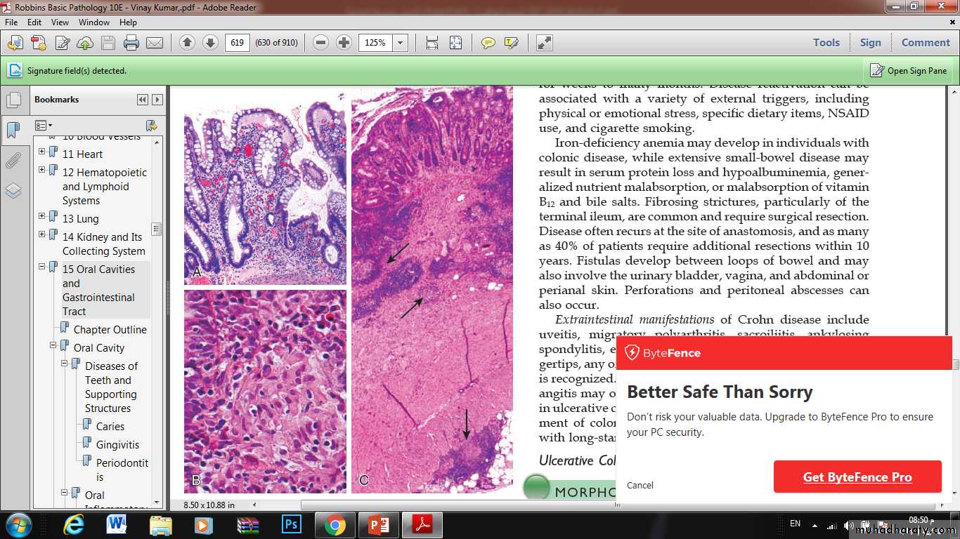 Small and Large Intestines