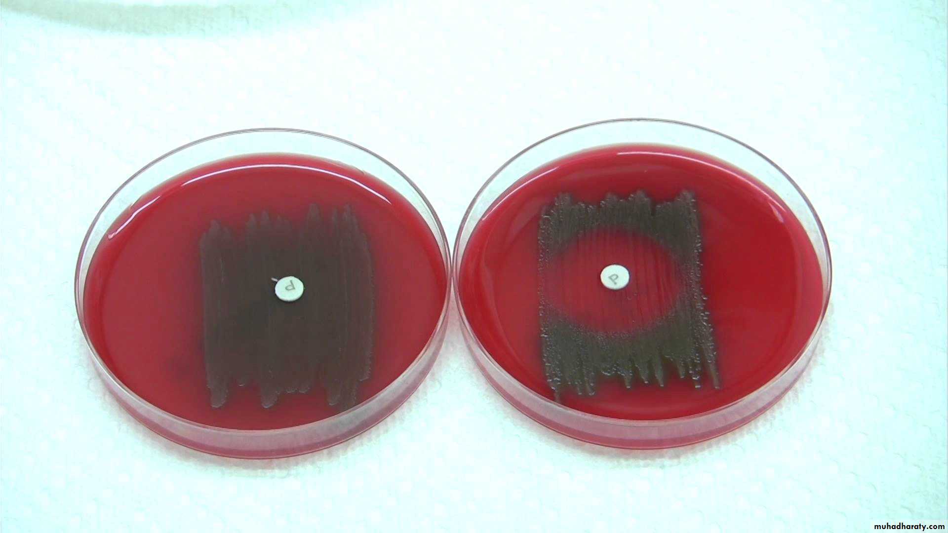 Streptococcus pneumonia