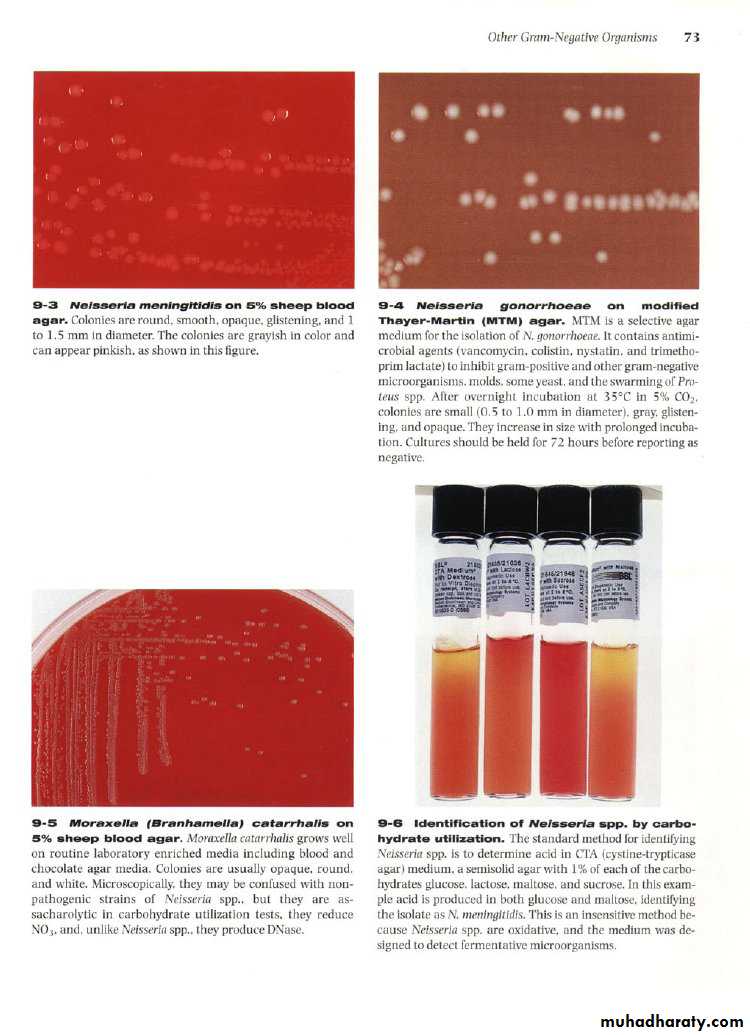 Streptococcus pneumonia