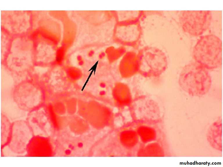 Streptococcus pneumonia