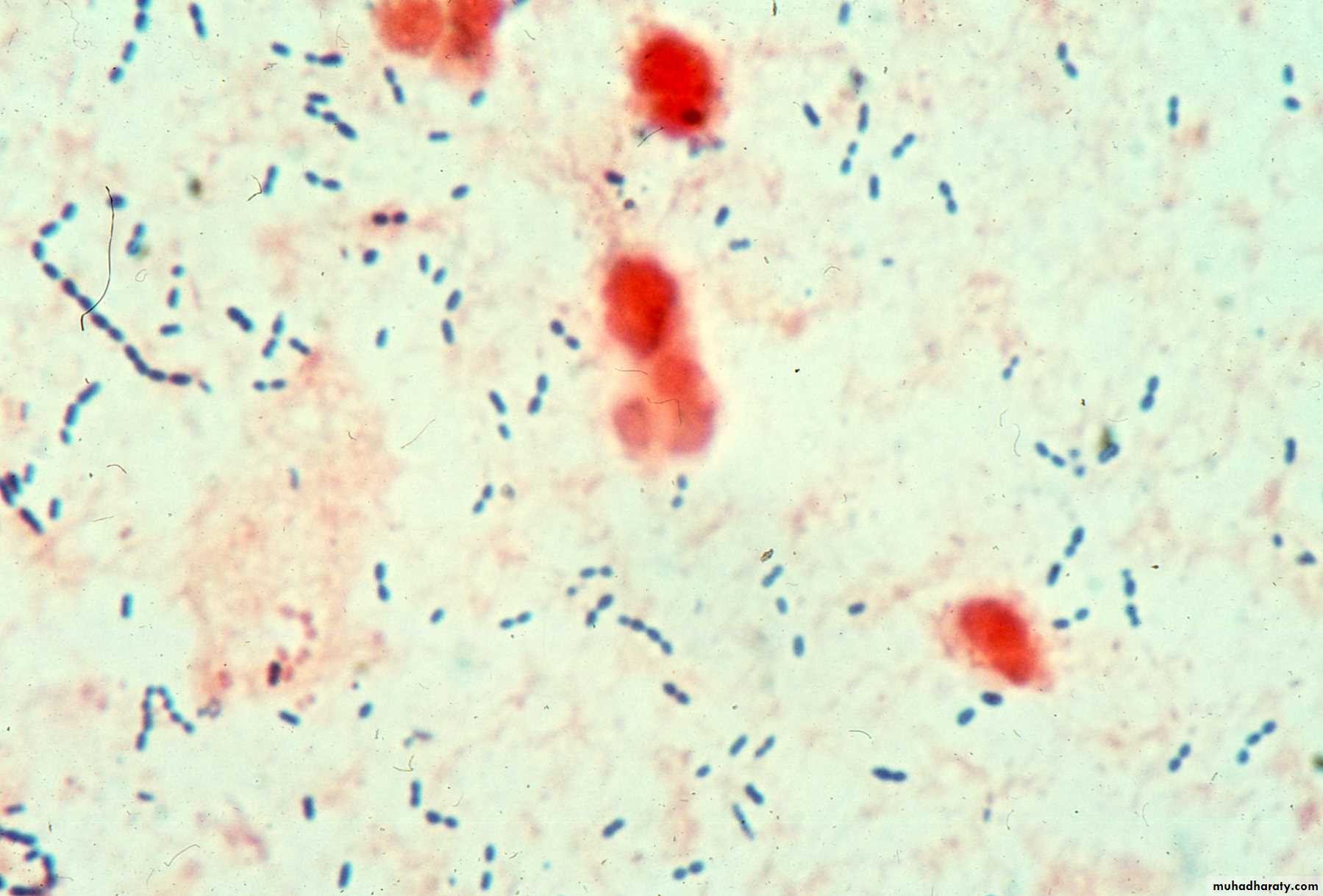 Streptococcus pneumonia