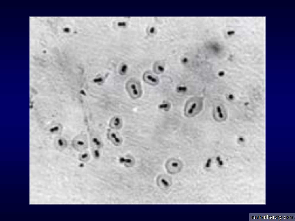 Streptococcus pneumonia