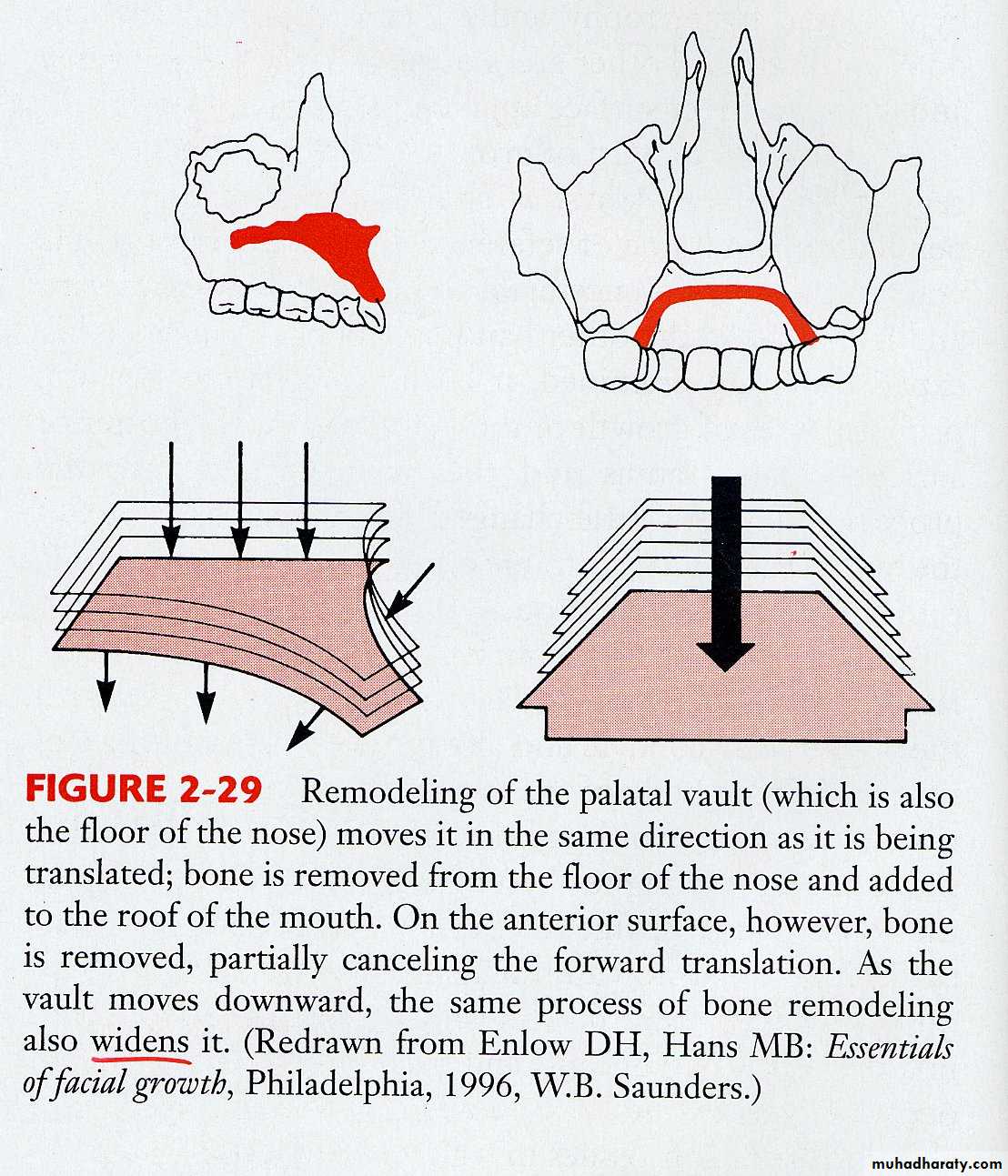 Types of Skeletal Growth