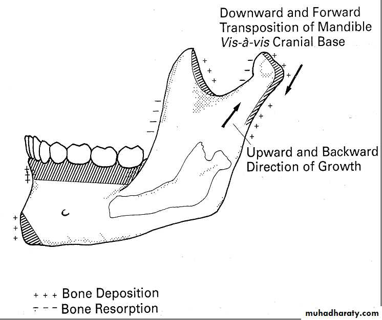 Types of Skeletal Growth