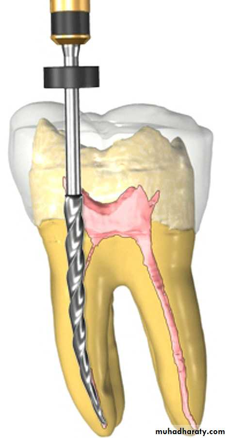 Endodontic instruments