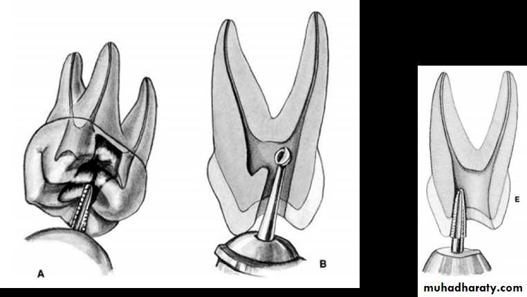 Endodontic instruments