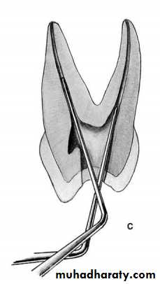 Endodontic instruments