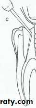 Endodontic instruments