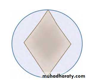Endodontic instruments