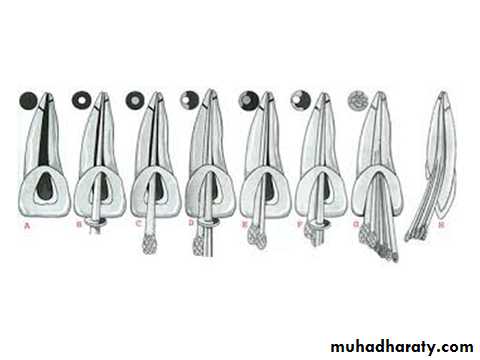 Endodontic instruments