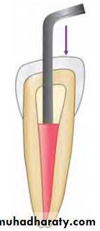 Endodontic instruments