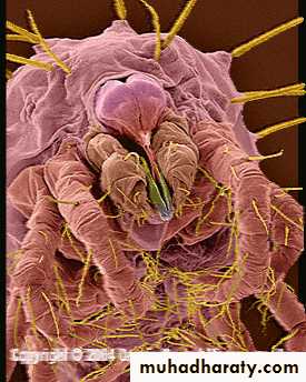 Disorders in Immunity
