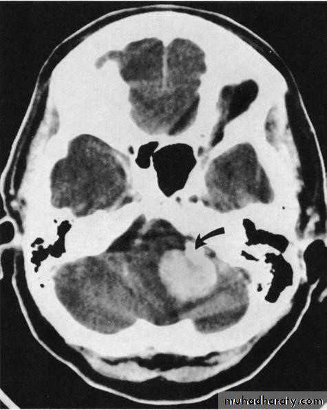 Brain imaging