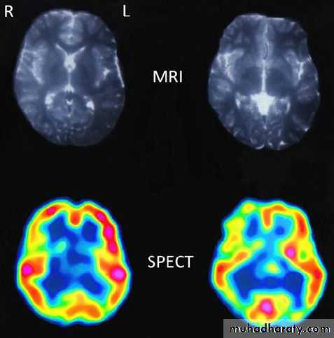 Brain imaging