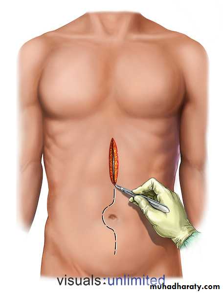 Surgical Instruments