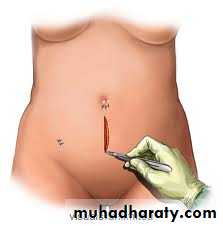 Surgical Instruments
