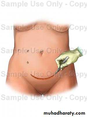 Surgical Instruments