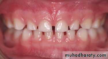 Development of dental occlusion