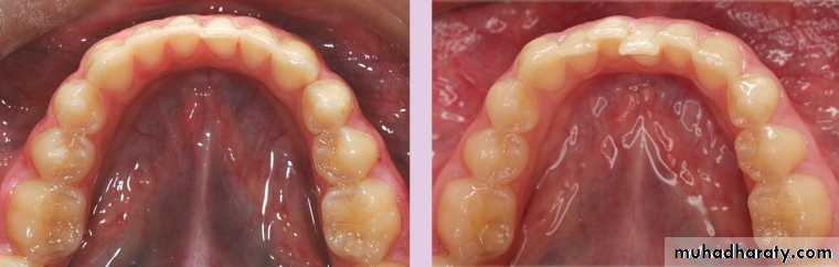 Development of dental occlusion