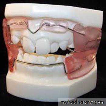 Myofunctional appliances