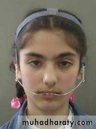 Extra oral appliances